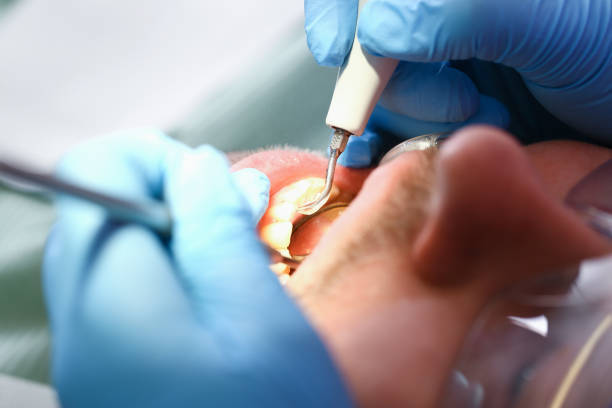 Best Cosmetic Emergency Dentistry in Schofield Barracks, HI